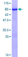 Human RNF146 Protein (Recombinant GST)