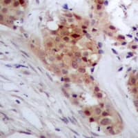TP53INP2 Antibody (C-Terminus)
