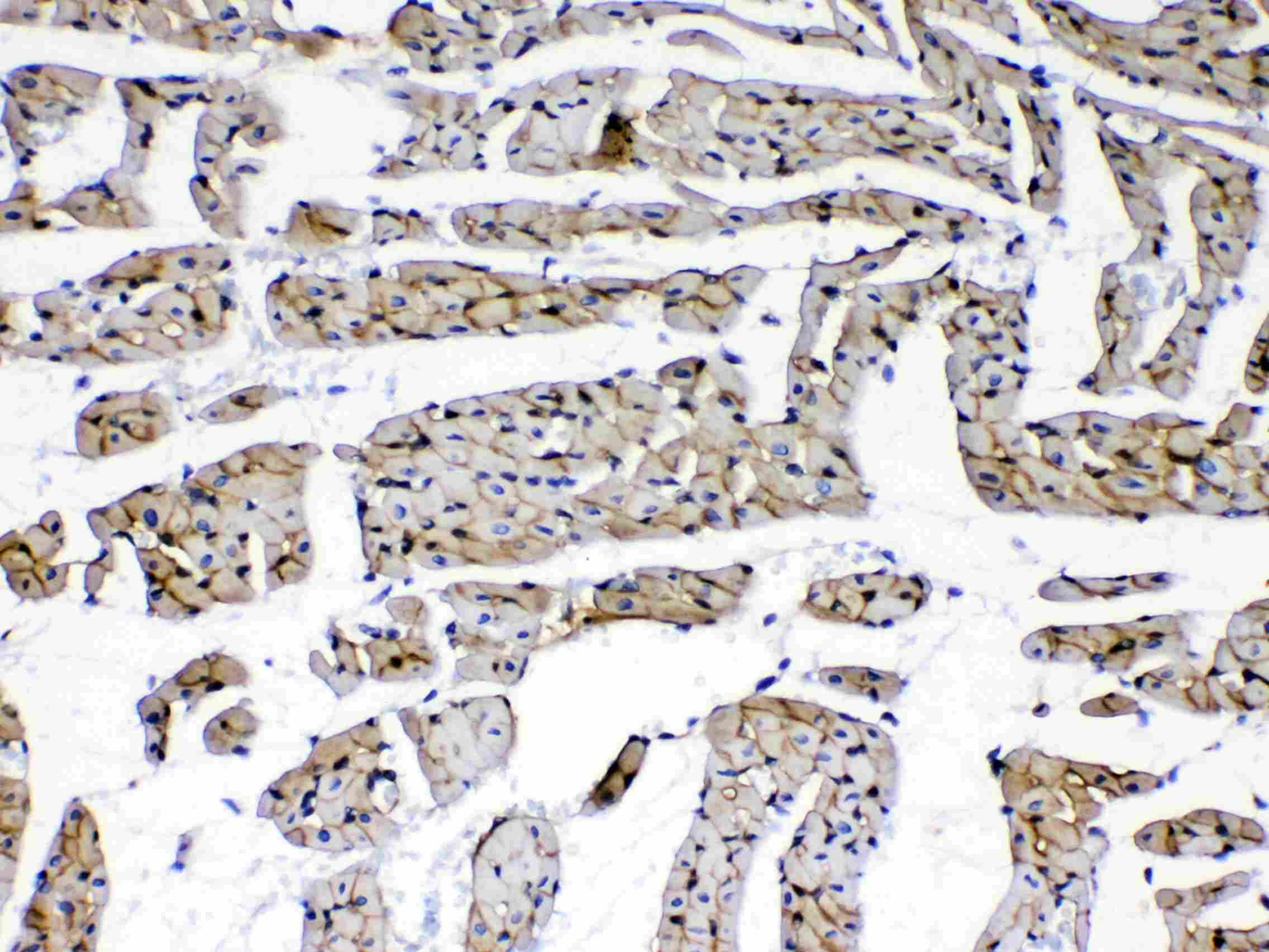 LAMC1 / Laminin Gamma 1 Antibody