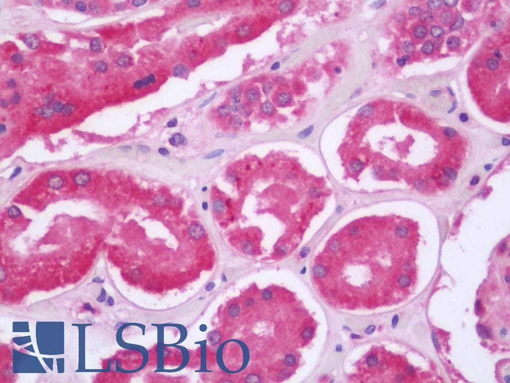 IHC-plus™ COMMD4 Antibody