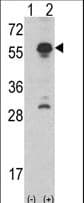 Polyclonal Rabbit anti-Human INHA / Inhibin Alpha Antibody (aa79-108, IHC, IF, WB)