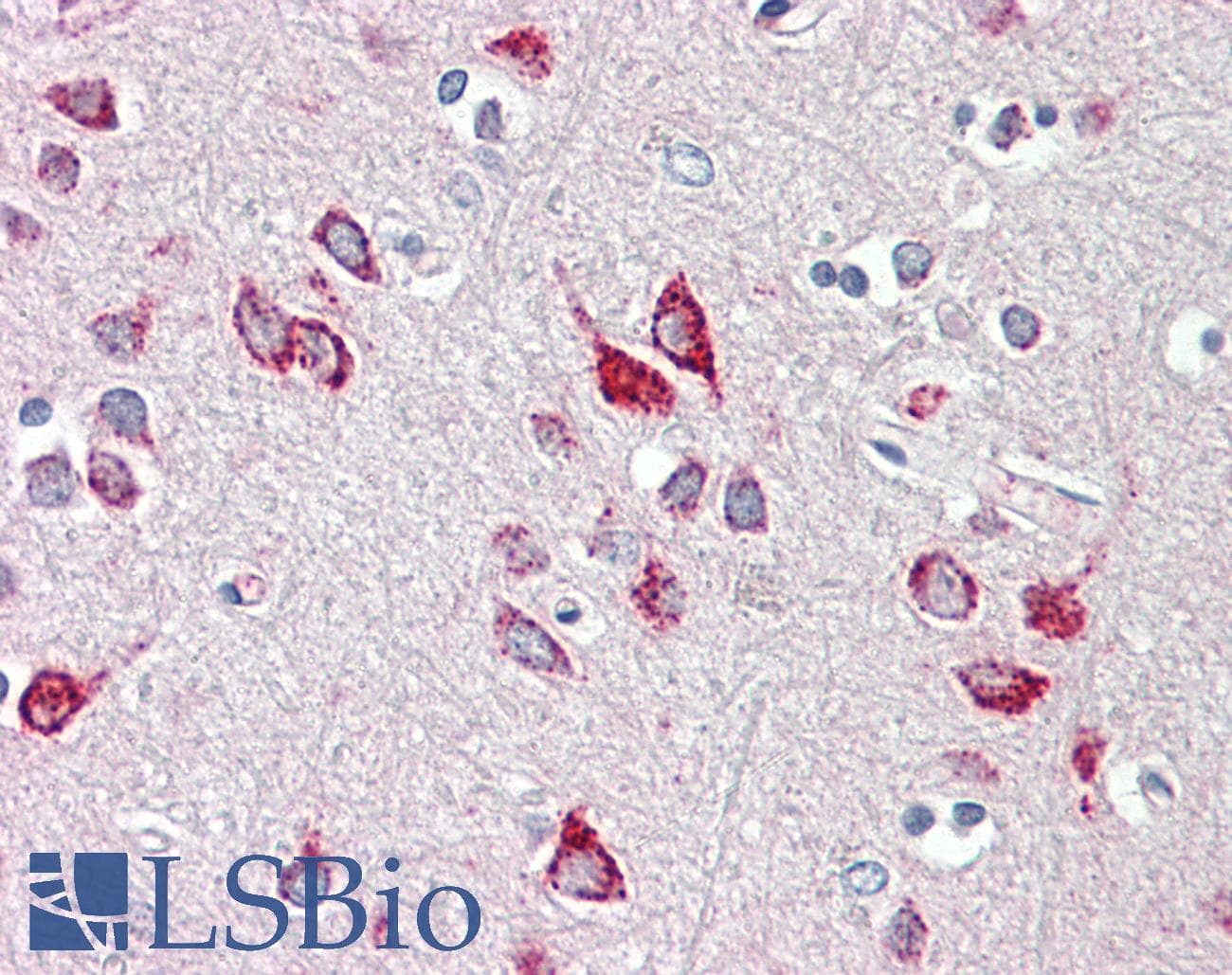 PathPlus™ Polyclonal Rabbit anti-Human HEXB Antibody (aa481-530, IHC, WB)