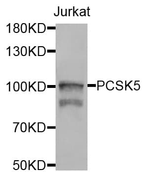IHC-plus™ PC5 / PCSK5 Antibody