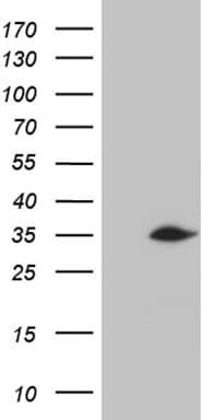 Monoclonal Mouse anti-Human C2orf80 Antibody (clone OTI3B6, WB)
