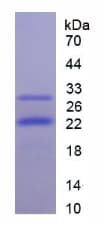 Human PIK3CB / PI3K Beta Protein (Recombinant His)