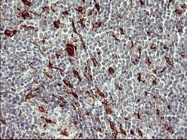 Monoclonal Mouse anti-Human MMP13 Antibody (clone OTI3F5, aa104-471, IHC, WB)