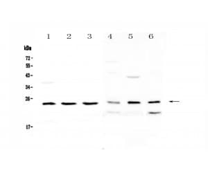 RAB6A / RAB6 Antibody