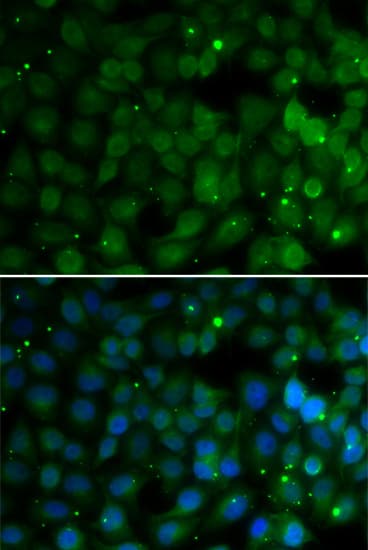 Polyclonal Rabbit anti-Human HPD Antibody (IHC, IF, WB)
