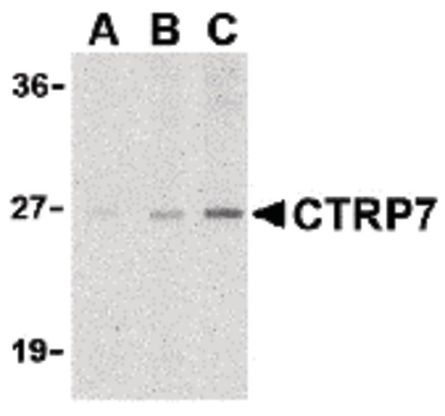 IHC-plus™ Polyclonal Rabbit anti-Human C1QTNF7 / CTRP7 Antibody (IHC, WB)