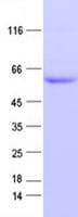 Human PHGDH Protein (Recombinant His, N-Terminal)