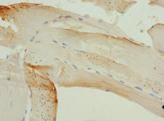 Polyclonal Rabbit anti-Human PIP5K1B Antibody (IHC, WB)