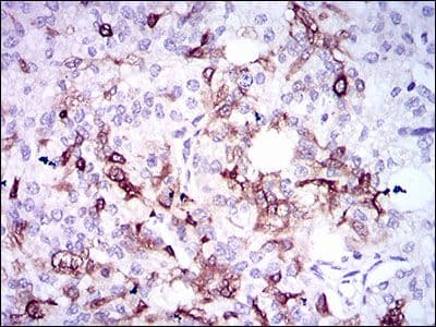 SPP1 / Osteopontin Antibody (Amino Acid: 167-314, clone 7C5H12)