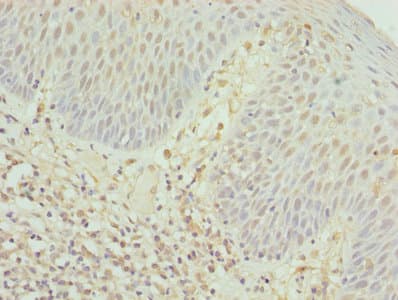CD8A / CD8 Alpha Antibody
