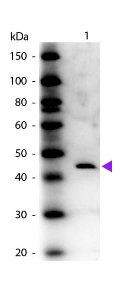 ADA / Adenosine Deaminase Antibody (Lyophilized)