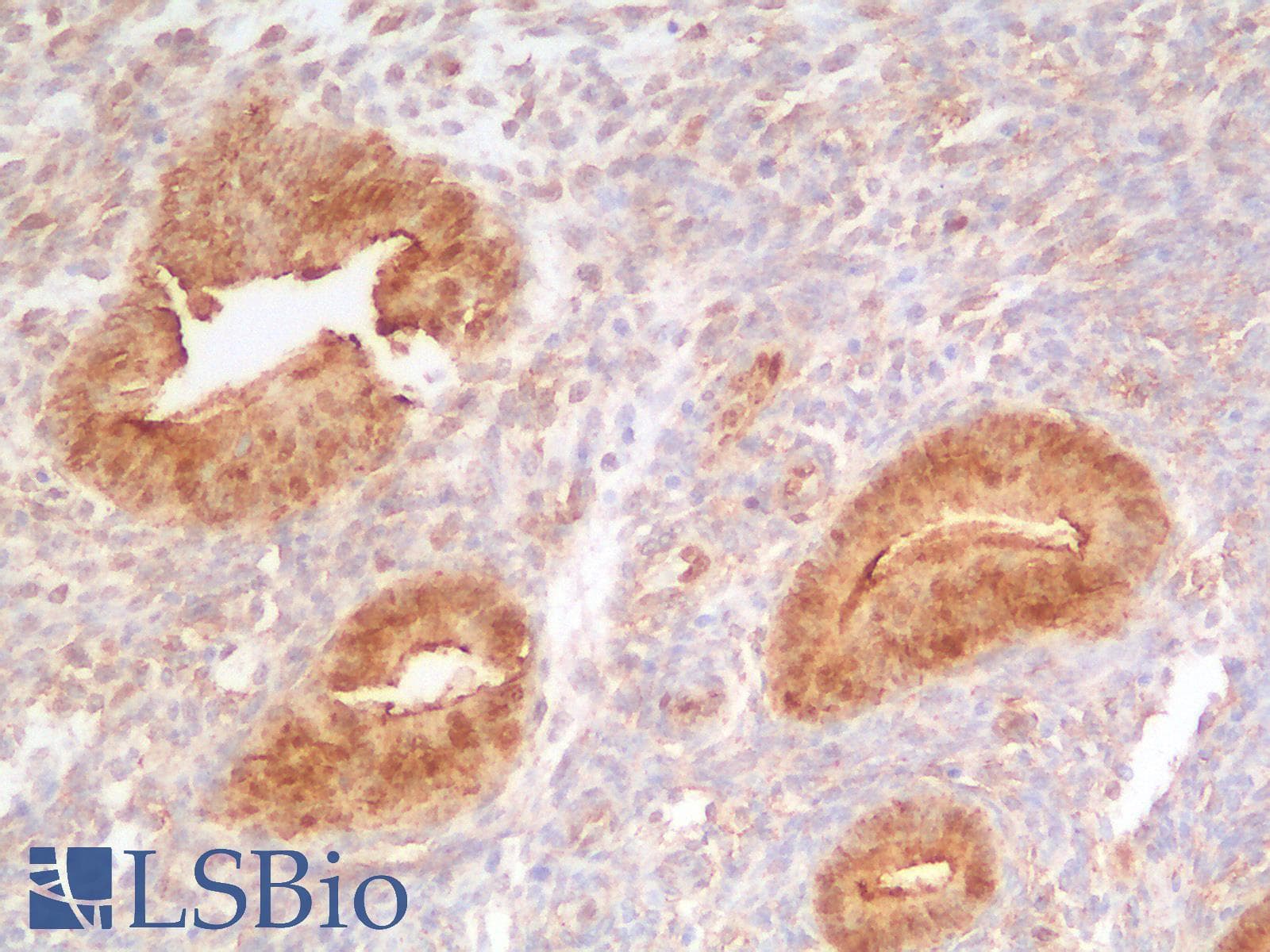PathPlus™ CTNNB1 / Beta Catenin Antibody (clone CTNNB1/2030R)