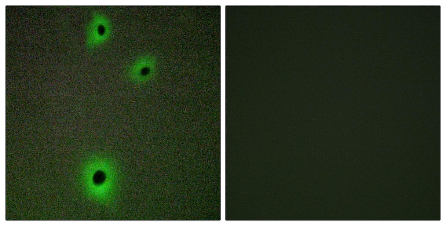 IGSF4C / CADM4 Antibody