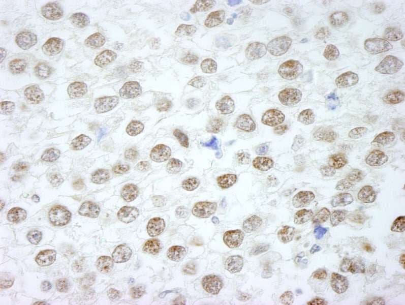 Polyclonal Rabbit anti-Human RIF1 Antibody (aa2425-C-term, IHC)