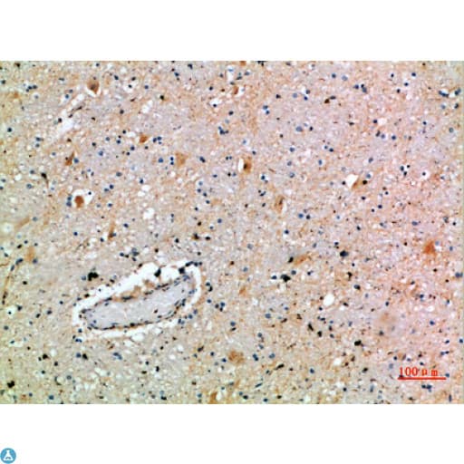 Polyclonal Rabbit anti-Human SPOP Antibody (WB)
