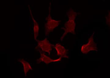 RPS6KB1 / P70S6K / S6K Antibody (phospho-Ser411)