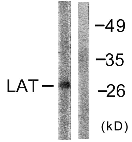 LAT Antibody (aa191-240)