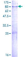 Human DCLRE1B Protein (Recombinant GST)
