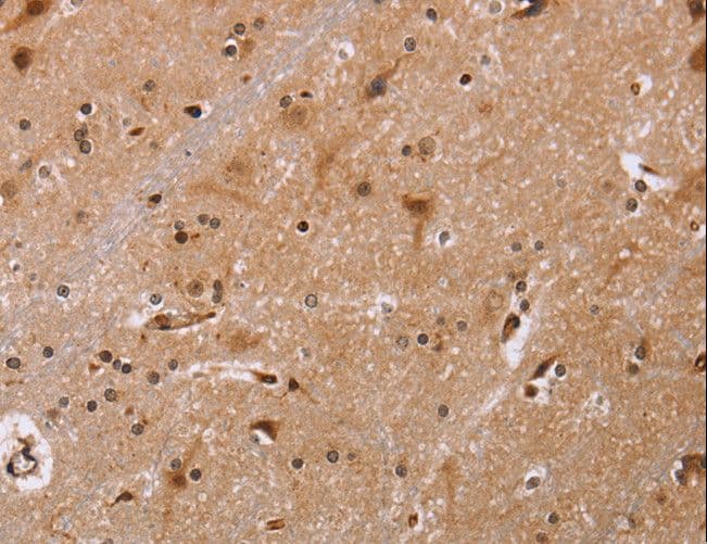 Polyclonal Rabbit anti-Human FBP2 Antibody (IHC)