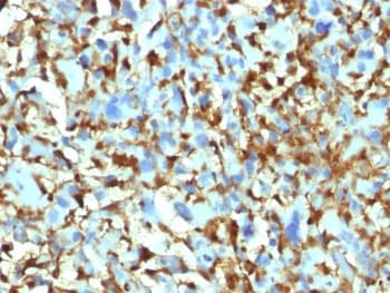 F13A1 / Factor XIIIa Antibody (clone F13A1/1448, Ready-to-Use)