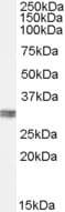 IHC-plus™ CLIC4 Antibody (aa8-20)