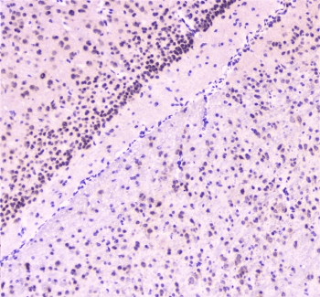 RAD51 / RECA Antibody