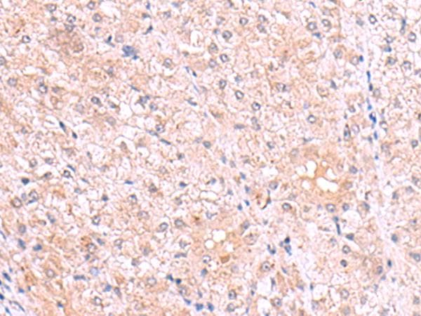 DJ858B16.2 / PISD Antibody