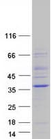 Human NEURL2 Protein (Recombinant Myc-DDK (Flag))