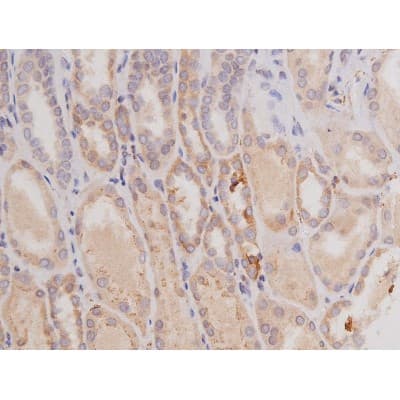 Polyclonal Rabbit anti-Human c-Kit / CD117 Antibody (IHC, IF, WB)