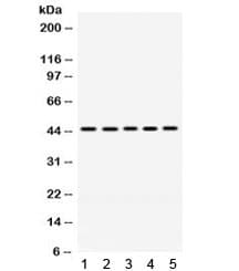 Polyclonal Rabbit anti-Human PGK1 / Phosphoglycerate Kinase Antibody (WB)