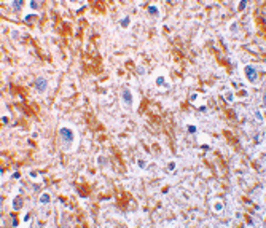 NRTN / Neurturin Antibody