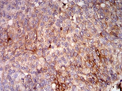 Monoclonal Mouse anti-Human HLA-B Antibody (clone 2G7B10, IHC, IF, WB)