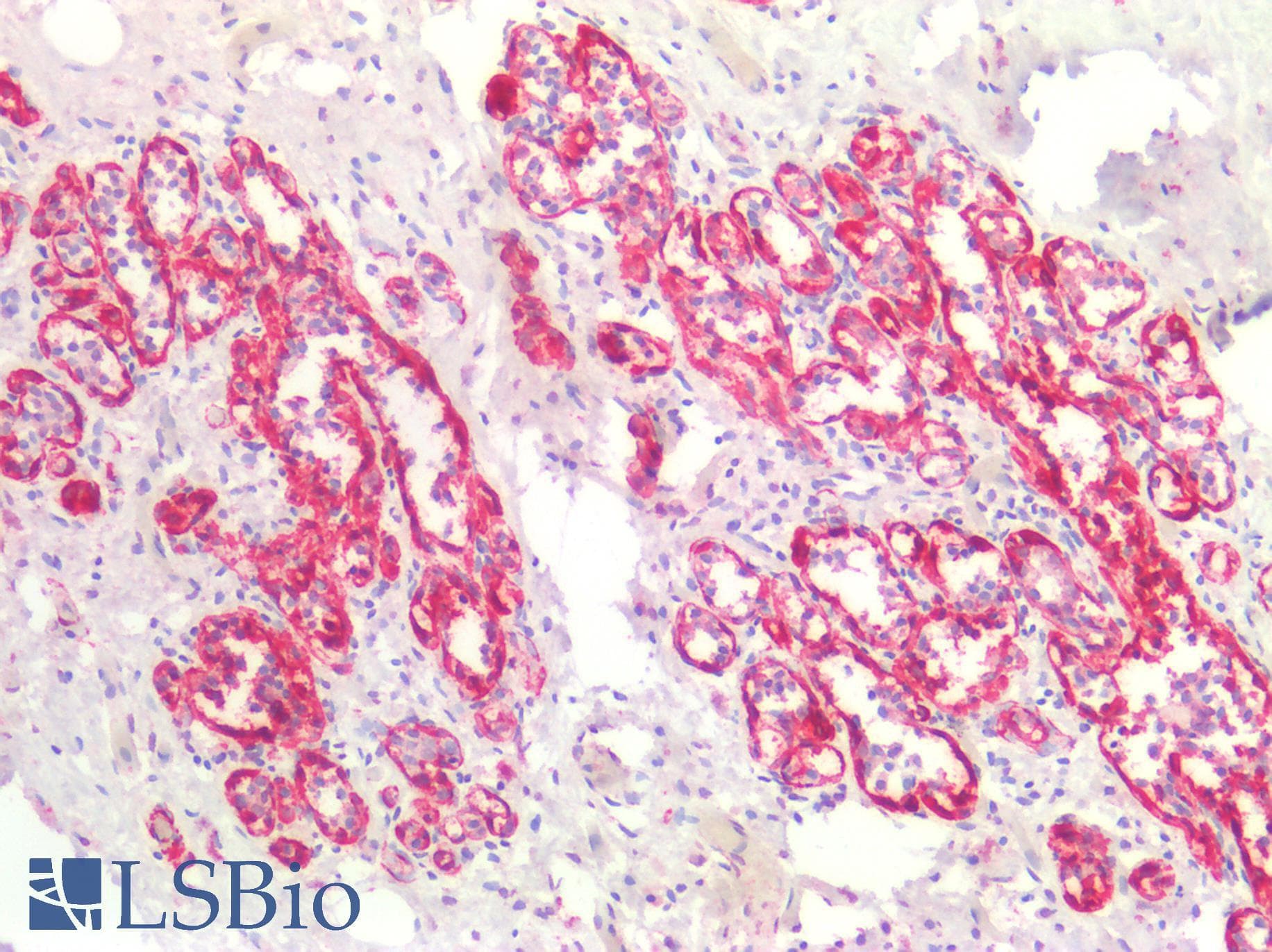 IHC-plus™ SMMHC / MYH11 Antibody