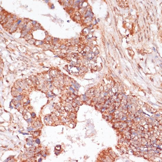 MAP2K3 / MEK3 / MKK3 Antibody