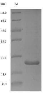 Woodchuck Hepatitis Virus HBV X Protein (Recombinant 6His, N-terminus)