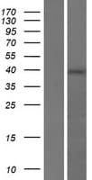 RGS7BP Protein (Over-Expression Lysate Myc-DDK (Flag))