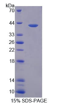 Human PK2 / PROK2 Protein (Recombinant His-GST)