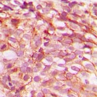Polyclonal Rabbit anti-Human BRAF / B-Raf Antibody (phospho-Ser446, IHC, WB)