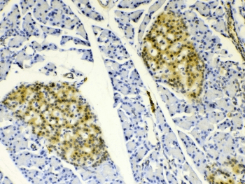 Polyclonal Rabbit anti-Human HSPB8 / H11 / HSP22 Antibody (IHC, WB)