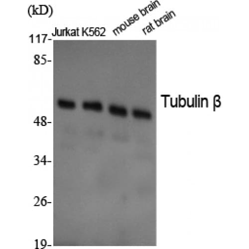 TUBB / Beta Tubulin Antibody (370-450 aa, C-terminal)