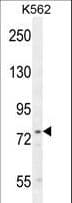 UROC1 Antibody (aa402-430)