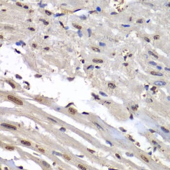 HNRPM / HNRNPM Antibody