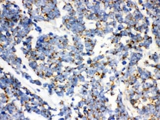 Polyclonal Rabbit anti-Human MtTFA / TFAM Antibody (IHC, WB)