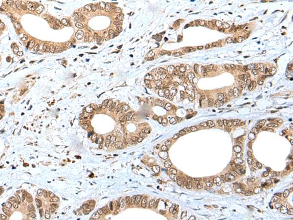 SPCS2 Antibody