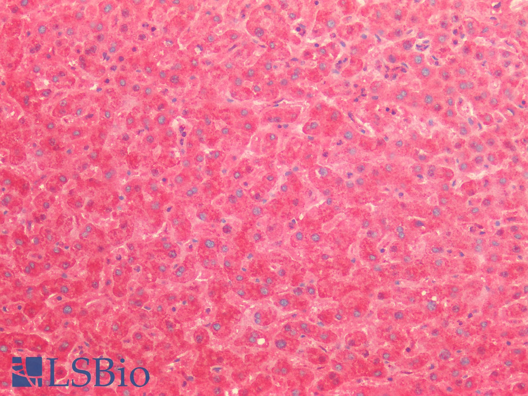 IHC-plus™ SOD2 / Mn SOD Antibody (aa64-175)