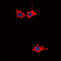 Polyclonal Rabbit anti-Human GRB10 Antibody (N-Terminus, IHC, IF, WB)