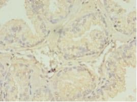 SPRING / TRIM9 Antibody (aa1-550)